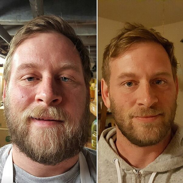 την εμφάνιση του ατόμου πριν και μετά την εγκατάλειψη αλκοόλ